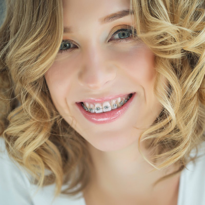 A smiling woman with blond hair and braces, wearing a white top.