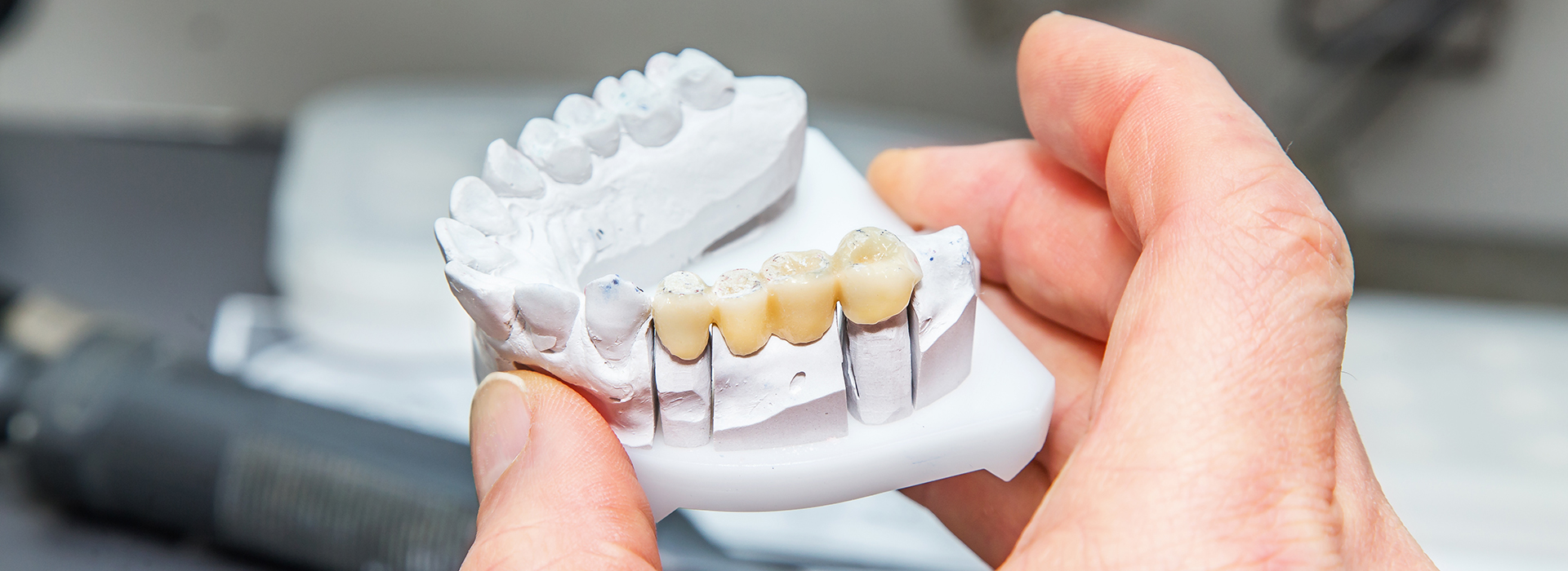 The image shows a person holding a 3D printed model of human teeth, likely for educational or demonstration purposes.