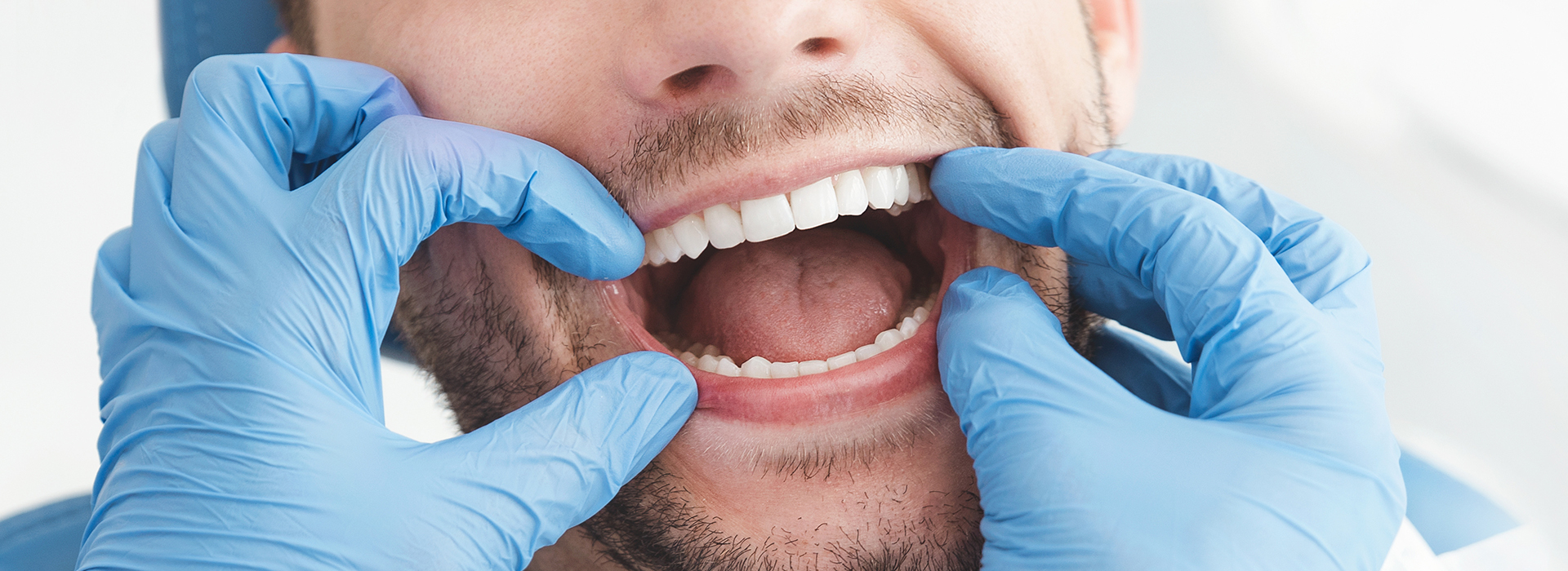 A man in a medical setting, wearing blue gloves and holding open his mouth with both hands, while smiling broadly.